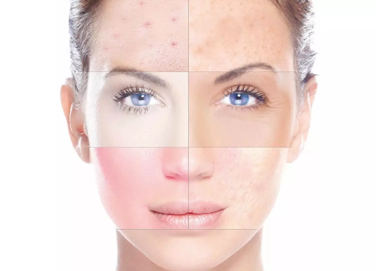 What micellar water? What is it and why? How to use micellar water for the face? 23921_9