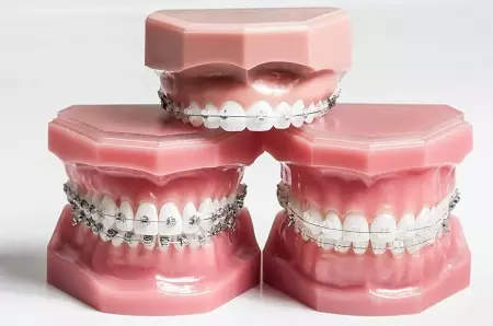 Orrigator Oral-B：BraunとAquacareからのProfessional Care Oxyjet MD20 4歯と口腔、ノズル、スペアパーツのためのMDH20.016.2 23976_9