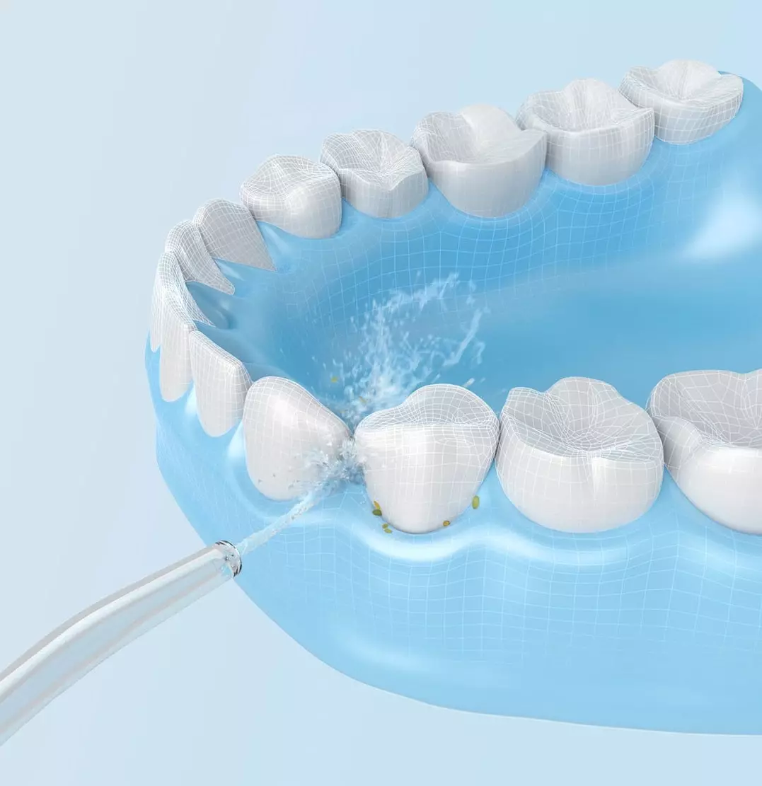 الري XIAOMI: Soocas W3 وMijia، الدكتور BEI F3 ونماذج لاسلكية أخرى للأسنان وتجويف الفم، وفوهات والتعليمات ونقد 23978_15
