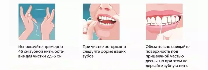 Threads ya meno ya mdomo: Jinsi ya kutumia? Mstari wa kliniki wa pro-mtaalam na floss kubwa, floss muhimu na satin floss, thread na thread isiyo ya kawaida. Jinsi ya Kuwafungua? 23988_17