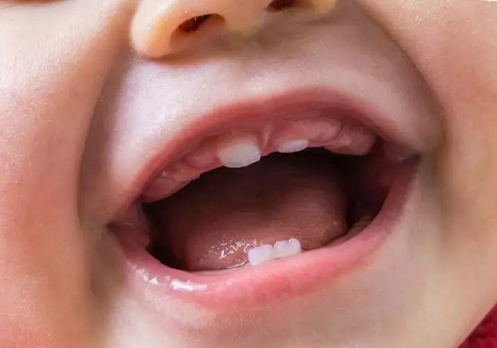 Върховете на пръстите на пасти за зъби на бебето на: избиране пръст четка за зъби за бебе, как децата използват силиконови четки за кърмачета 24003_20