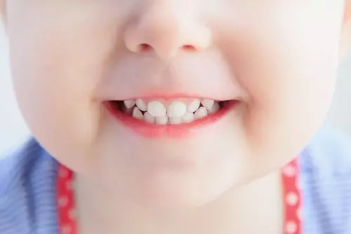 بچوں کے دانتوں کا برش: الٹراساؤنڈ اور آواز، سلیکون اور دیگر بچوں کے دانتوں کے لئے 1-5 سال، 10 سال سے زائد عمر کے نوجوانوں کے لئے، کس طرح منتخب کریں 24009_3
