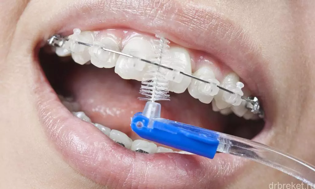 Οδοντόβουρτσα: Οι καλύτερες βούρτσες για δόντια, μπαμπού και ιονική, πώς να επιλέξετε, χειροκίνητα και διαθέσιμα, άλλα είδη 24014_26