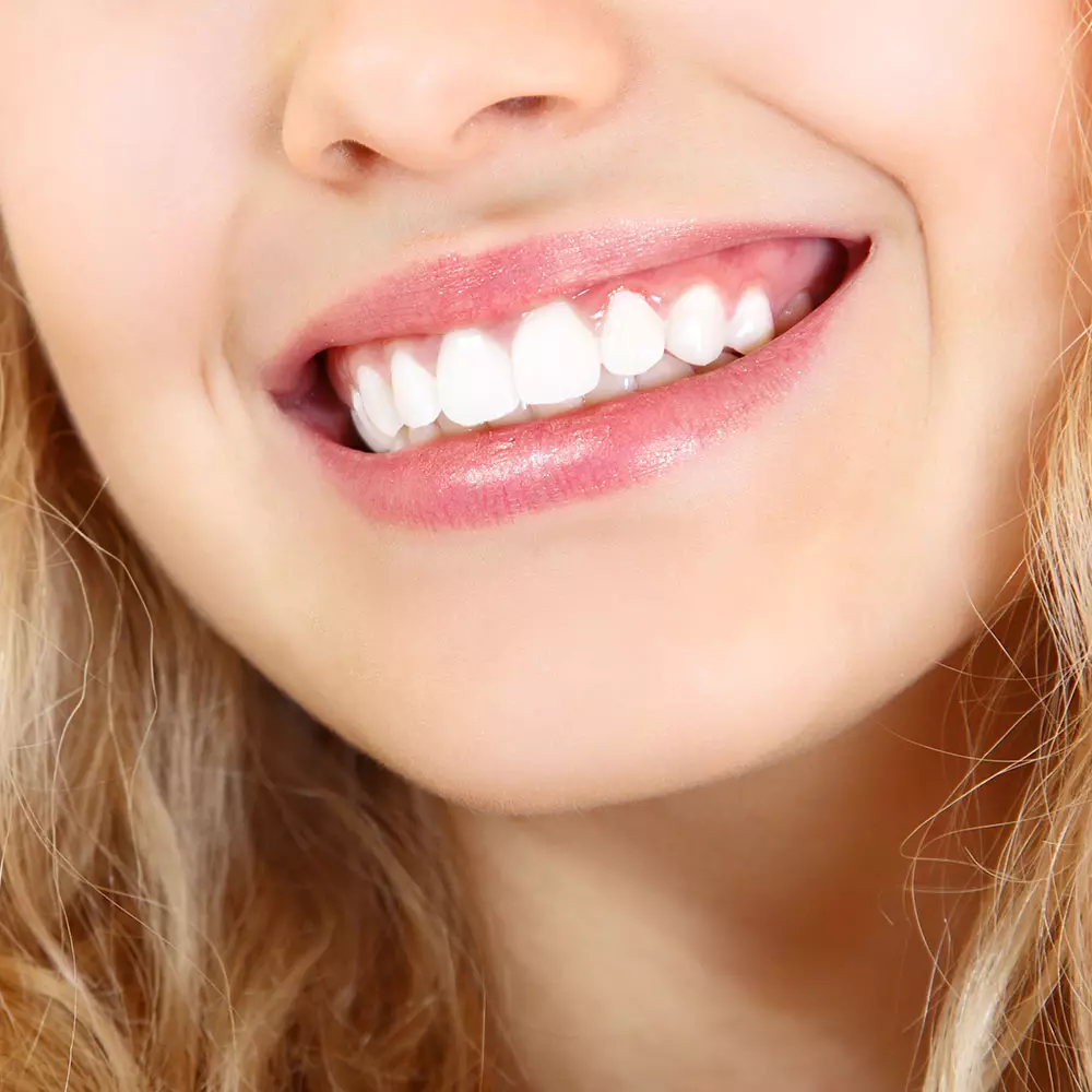 Πώς να λευκαίνουν τα δόντια σας ενεργοποιημένο άνθρακα; Λεύκανση στο σπίτι, τα οφέλη και τον καθαρισμό της βλάβης. Πόσες φορές μπορείτε να βουρτσίζετε τα δόντια σας με άνθρακα; Σχόλια 24065_16