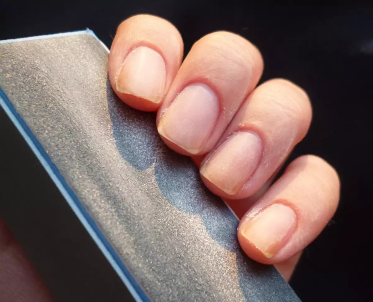 Ногти перед покрытием. Отполированные ногти. Шлифовка ногтевой пластины пилкой. Ногти после снятия гель лака. Шлифует ногти.