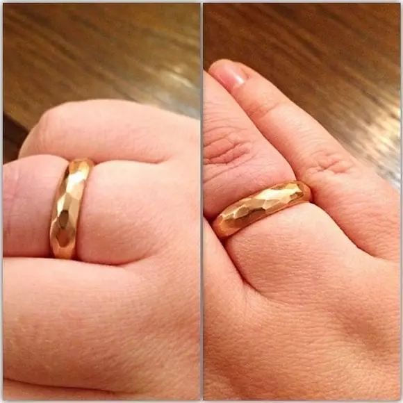 अंगूठी से अंगूठी को कैसे हटाएं (4 9 फोटो): गूंज से कैसे निकालें या धागे के साथ एक अंगूठी को सूजन करें 3112_41