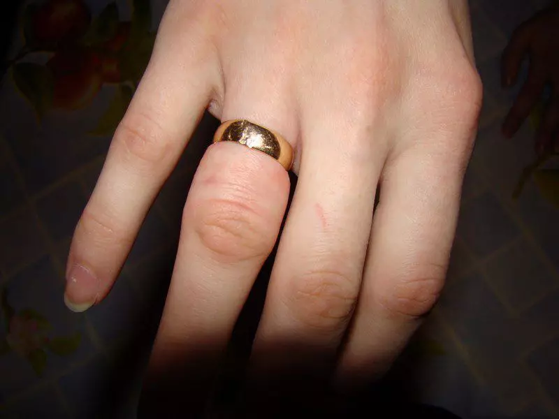 अंगूठी से अंगूठी को कैसे हटाएं (4 9 फोटो): गूंज से कैसे निकालें या धागे के साथ एक अंगूठी को सूजन करें 3112_42