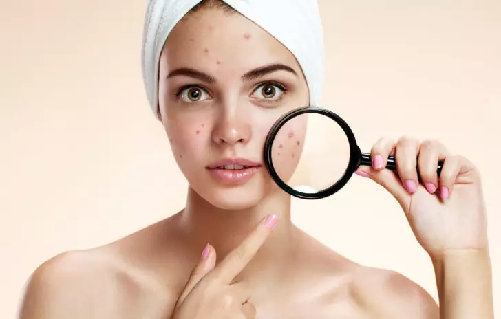 Kleurloze henna voor het gezicht: White Hu Nu gebruiken voor huidhuid en welk effect erop? Helpt ze met acne en rimpel? 4208_16
