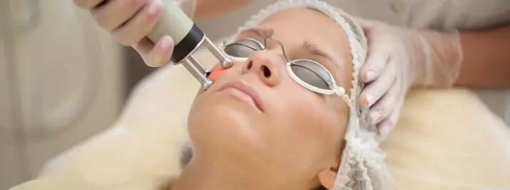 Laser Rejuvenation (34 wêne): Rêbaza nûjenkirina fraksiyonê 