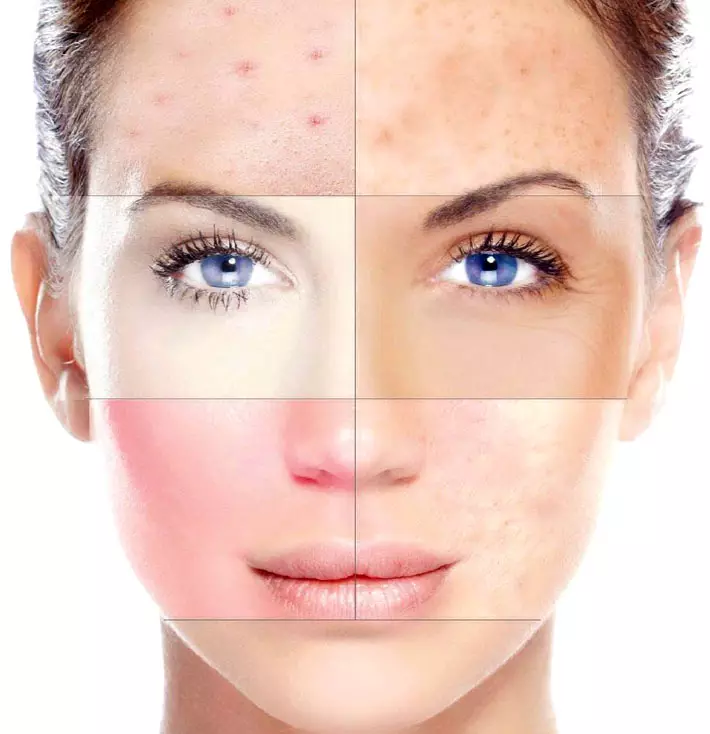 Îngrijirea feței (59 de fotografii): Cum să vă îngrijiți pielea în jurul ochilor acasă, recenzii 4239_7