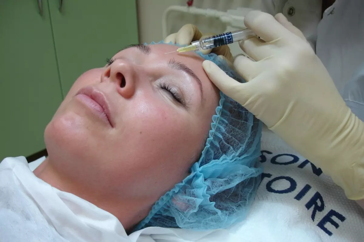 Mesoterapi ansiktsbehandling (65 bilder): Vad det är, ett icke-oförvärv och fraktionellt förfarande, recensioner 4241_33