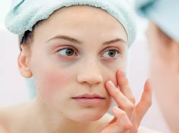 Wie verkleinern Sie Blutergüsse mit Kosmetika unter den Augen? Was macht schwarze Kreise? Die besten Kosmetika von dunklen Flecken 4355_5