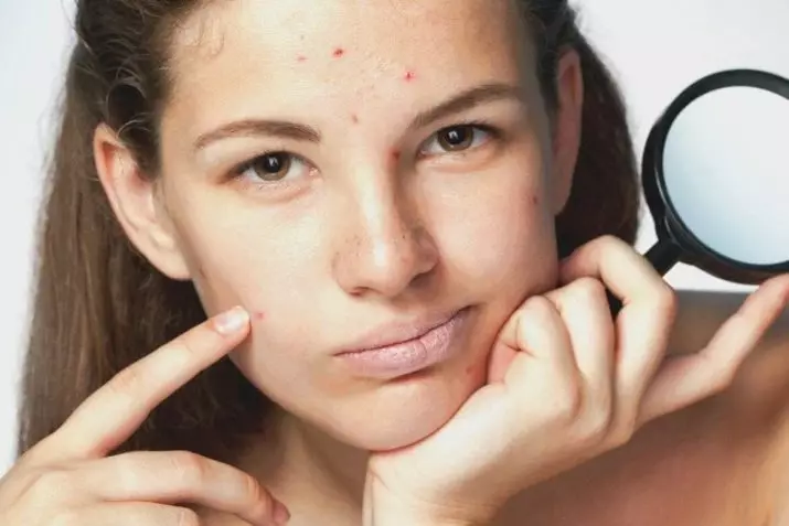 Kozmetika pre problémovú kožu: Odchod z organickej kozmetiky na tvár v lekárňach a najlepšia dekoratívna kozmetika 4360_4