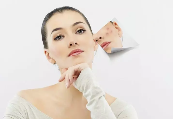Kozmetika pre problémovú kožu: Odchod z organickej kozmetiky na tvár v lekárňach a najlepšia dekoratívna kozmetika 4360_7