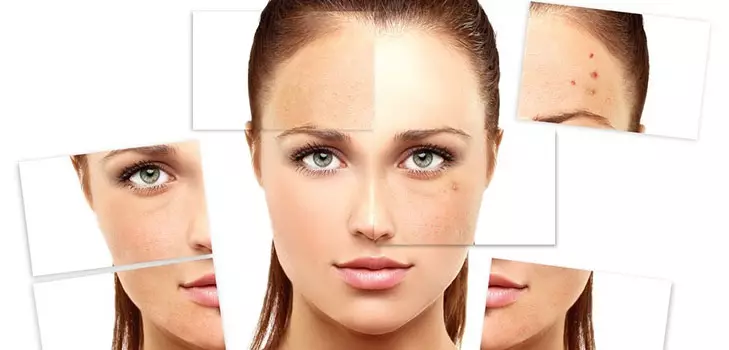 Kosmetik untuk Lemak dan Masalah Kulit: Semakan kosmetik farmasi untuk wajah dengan liang maju, profesional terbaik dan meninggalkan kosmetik 4363_5