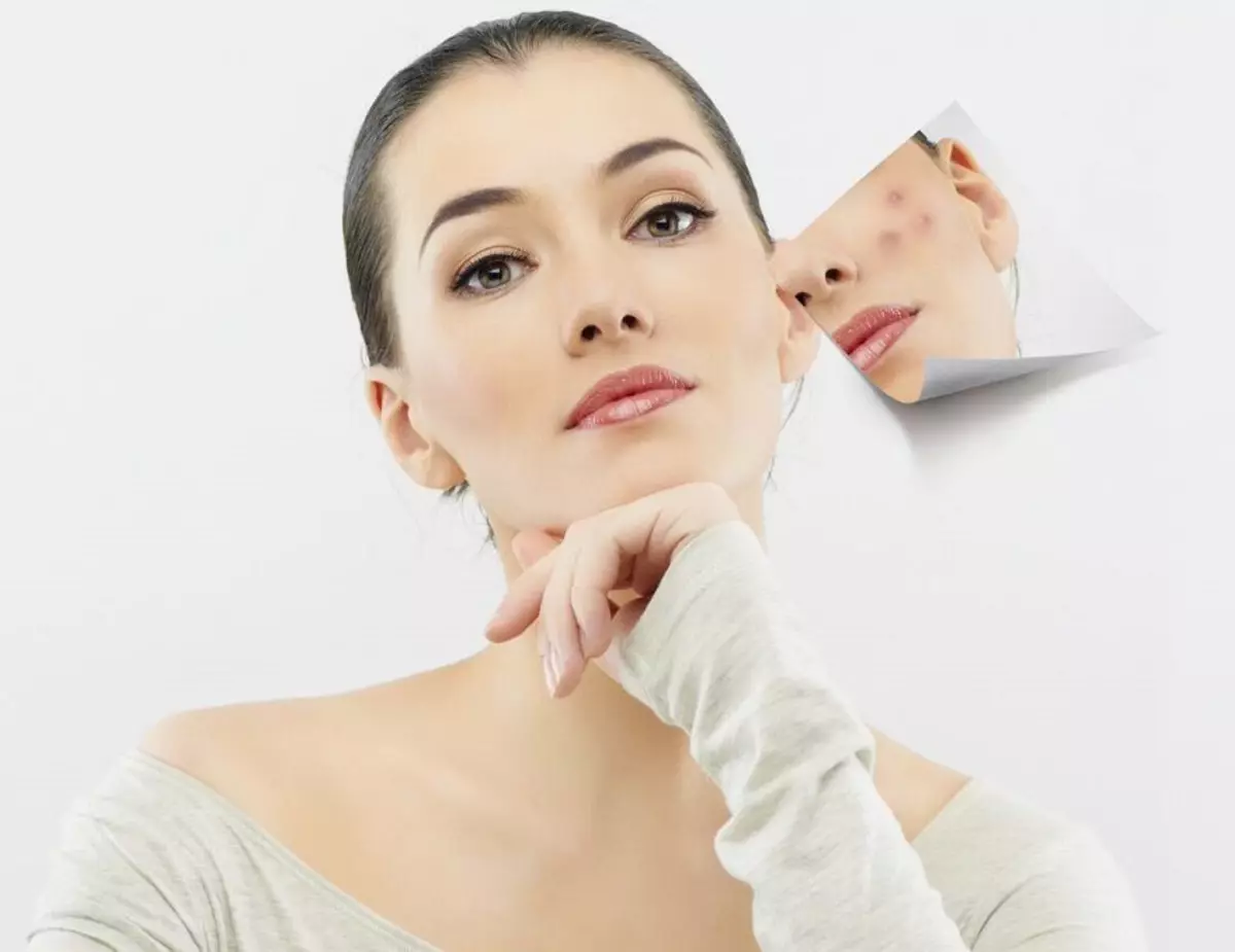 Козметика за масну и проблематичну кожу: Преглед фармације козметике за лице са напредним порама, најбољем професионалном и напуштањем козметике 4363_7