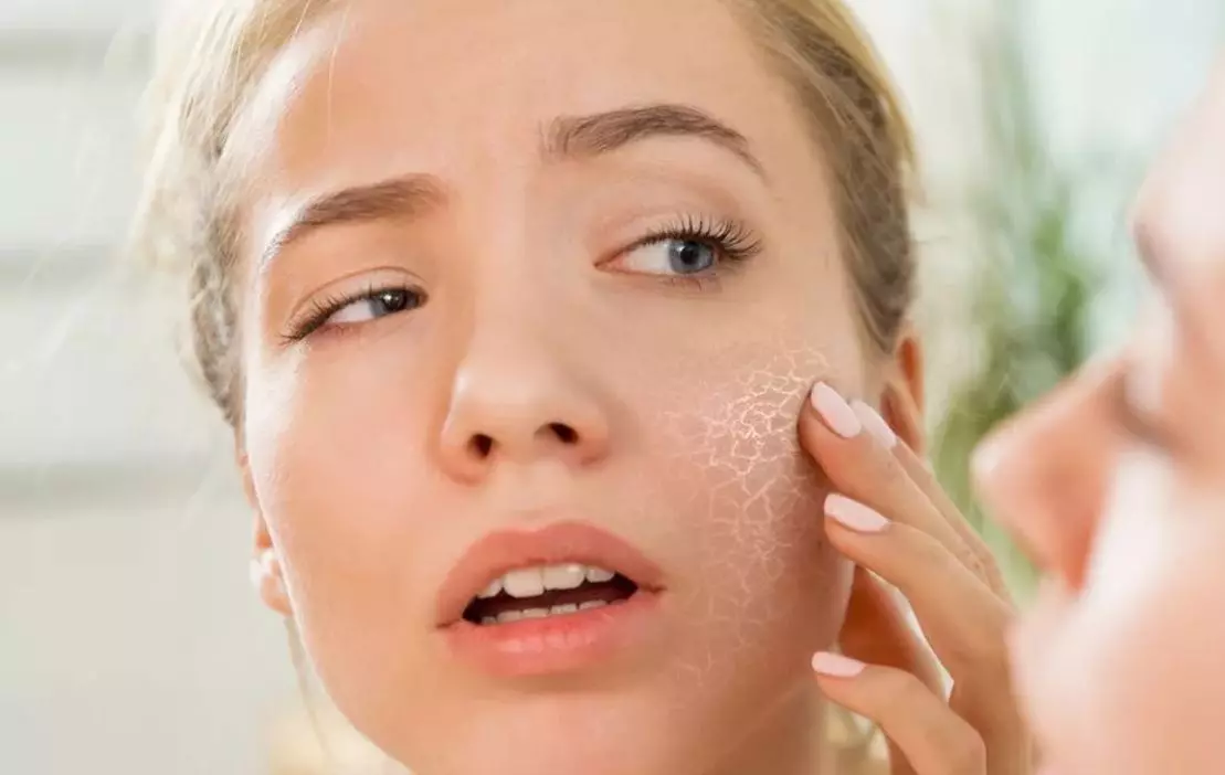 Avene Cosmetics: Ciri-ciri Farmasi Kosmetik untuk Masalah Kulit, Perihalan Pengilang, Ulasan Sunscreen, Kosmetologi 4446_11
