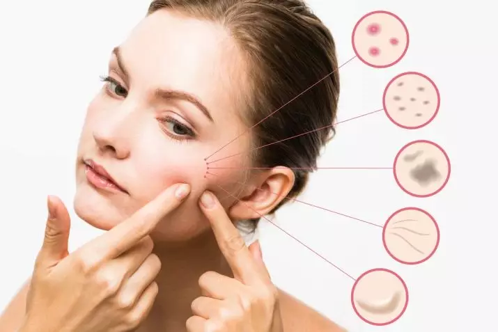 Avene Cosmetics: A gyógyszertári kozmetikumok a problémás bőrre, a gyártó leírása, Sunscreen Vélemények, Cosmetologists Vélemények 4446_20
