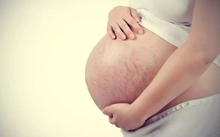 Smör från streckmärken under graviditeten: Hur man använder gravid eterisk olja mot celluliter? Recensioner 4803_2