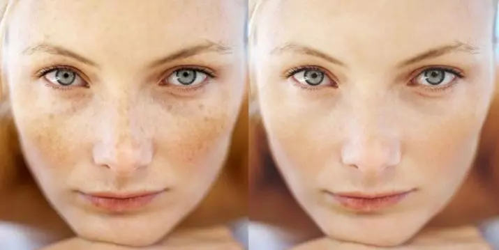 Kamferolie voor gezicht: toepassing van dergelijke maskers in cosmetologie van acne en rimpels op de huid rond de ogen, beoordelingen 4824_11