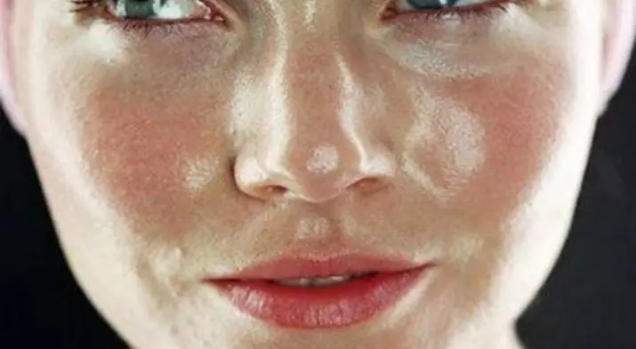 Kamferolie voor gezicht: toepassing van dergelijke maskers in cosmetologie van acne en rimpels op de huid rond de ogen, beoordelingen 4824_17