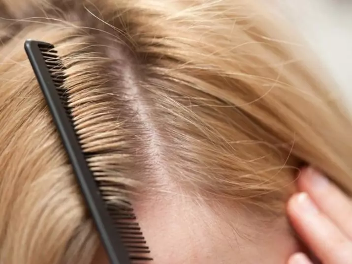 Castor Hair Oil (20 fotek): Metody použití rayan a ricinových olejů pro růst vlasů doma, recenze 4845_7
