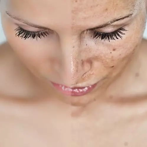 Características do óleo de mamona para o rosto e resulta após o seu uso (26 fotos): máscaras de rugas e manchas de pigmento em cosmetologia, aplicando creme com iodo de acne na pele do rosto, Reviews 4847_17