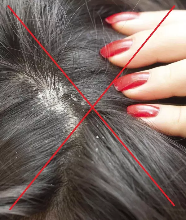 Comment peindre les cheveux d'oignon de cheveux? 18 Photo correcte de cheveux gris, foncé et léger à la maison 5245_6