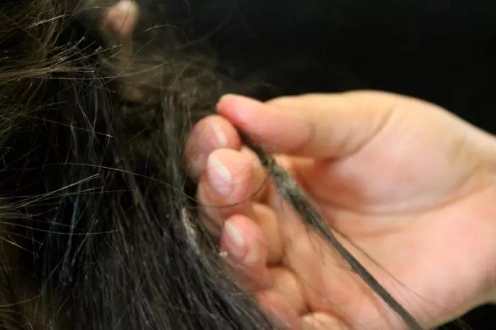 व्यापक बाल को हटाया: कैसे और क्या घर पर व्यापक बाल हटाने के लिए इसका मतलब है? हटाने के लिए तरल पदार्थ का चयन करें 5518_13