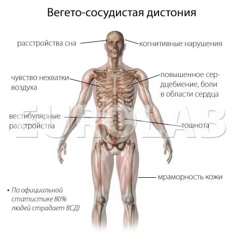 Fanitarana volo Espaniola: endri-javatra amin'ny teknolojia fanitarana toy izany. Inona no atao hoe fananganana mangatsiaka? 5528_10