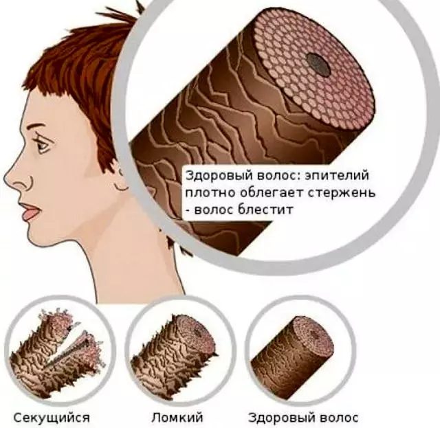 Ochrona termiczna włosów z prasowania: najlepsze środki do ochrony podczas prostowania włosów w domu. Opinie 6159_5