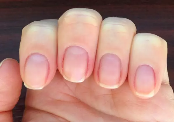 I-Manicured Oncured (iifoto ezili-18): Yintoni kwaye njani ekhaya? Ungaya njani ukusuka kwi-temicure ye -dd ukuya kwindawo eyomileyo yokususa i-cuticle? 6241_8