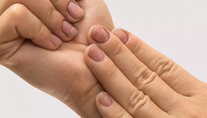Maniküre in der Geburtsklinik (12 Fotos): Sie können oder können nicht in die Geburtsklinik gehen mit den Nägeln in den Händen gemacht? 6242_6