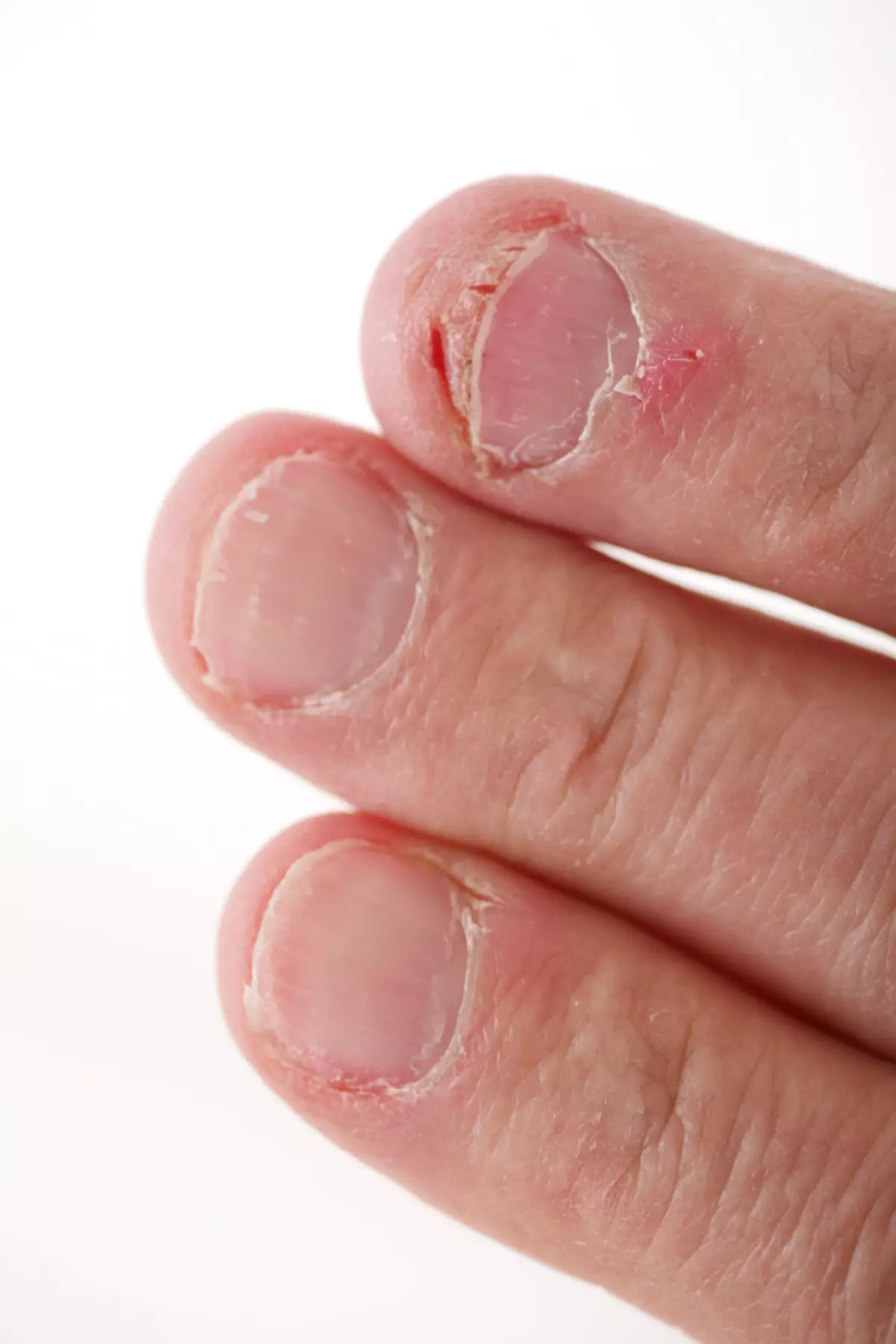 Omsorg för illamående Naglar: Hur man bryr sig om zoomade gel naglar? 6565_11