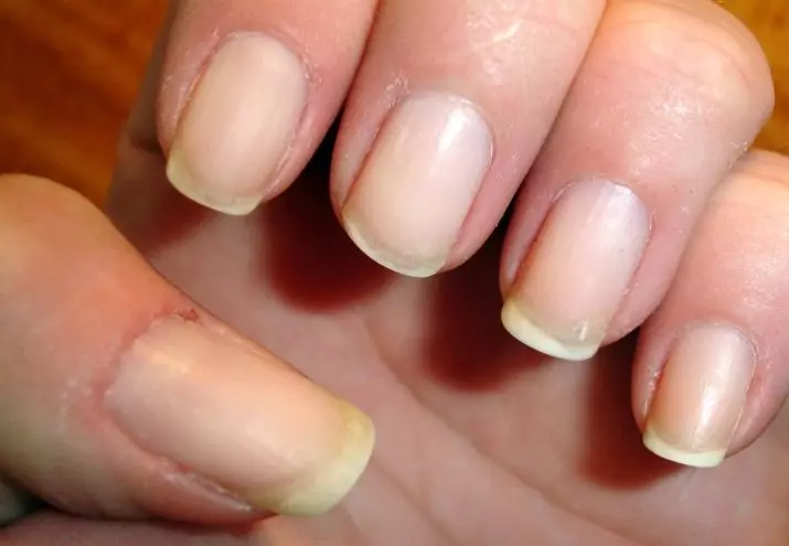 Briga o noktima mučnine: Kako se brinuti za zumirane gel nokte? 6565_15