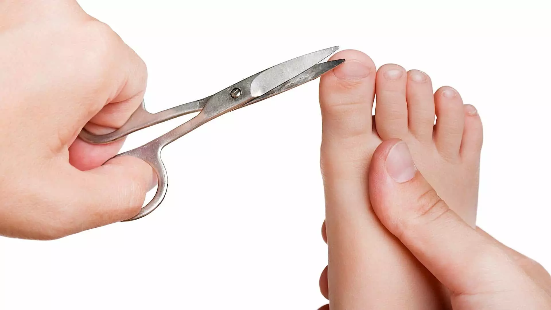 ¿Cómo cortar las uñas en las piernas? 20 Fotos ¿Cómo cortar a un niño y cómo cortar las uñas gruesas a los ancianos? 6601_19