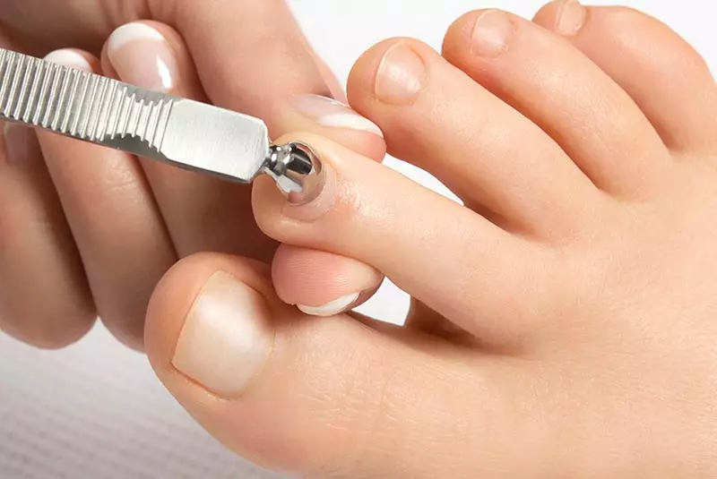 Spa-pedicure (26 foto's): wat is het? Stap-by-Step-technologie en beoordelingen 6650_11